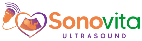 Sonovita